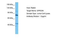 GPRC6A Rabbit anti-Human, Polyclonal, Novus Biologicals 0.1 mL | Buy Online | Novus Biologicals | Fisher Scientific